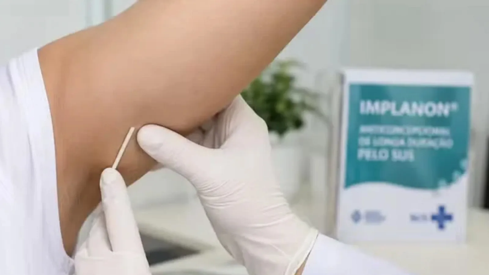 Anvisa amplia para cinco anos prazo de validade de implante contraceptivo